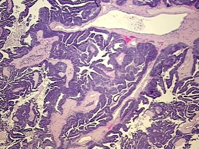 FFPE Tissue Blocks, Ovary: bilateral | CB804755 | OriGene Technologies Inc.