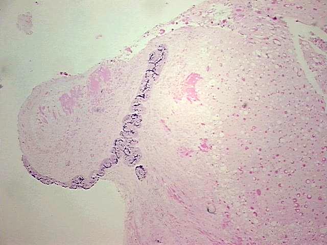 FFPE Tissue Blocks, Ovary: right | CB808070 | OriGene Technologies Inc.