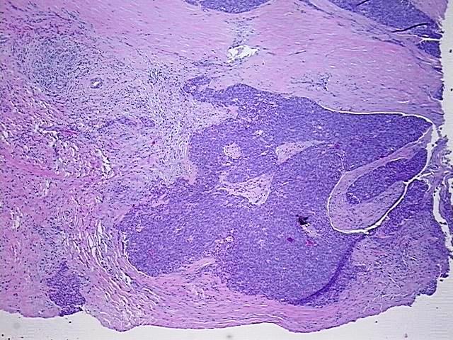 FFPE Tissue Blocks, Thymus - image 1