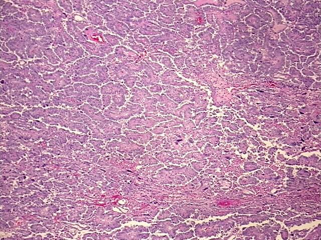 FFPE Tissue Blocks, Ovary | CB811297 | OriGene Technologies Inc.