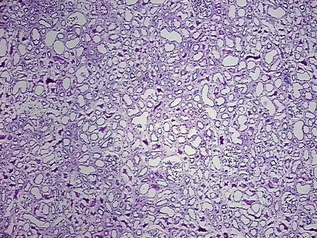 Empty Tissue Block Frozen Tissue Blocks, Kidney | CB508969 | OriGene Technologies Inc.