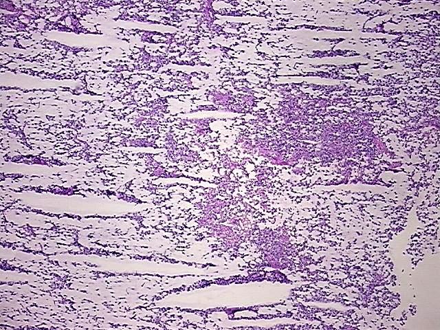 Frozen Tissue Blocks, Testis | CB533933 | OriGene Technologies Inc.