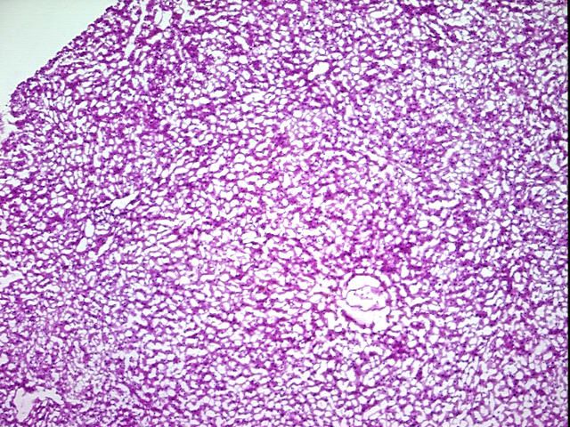 Frozen Tissue Blocks, Liver | CB607346 | OriGene Technologies Inc.