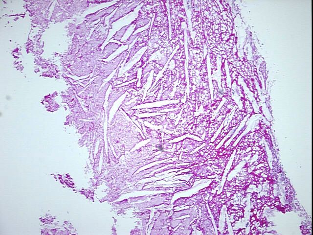 4x Image