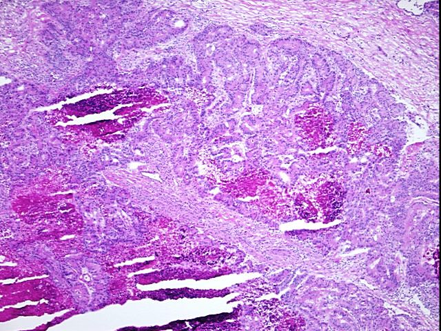 Frozen Tissue Blocks, Endometrium | OriGene Technologies Inc.