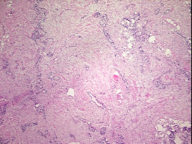 Frozen Tissue Blocks, Endometrium | OriGene Technologies Inc.