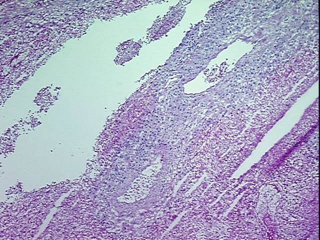 Frozen Tissue Blocks, Lung | OriGene Technologies Inc.