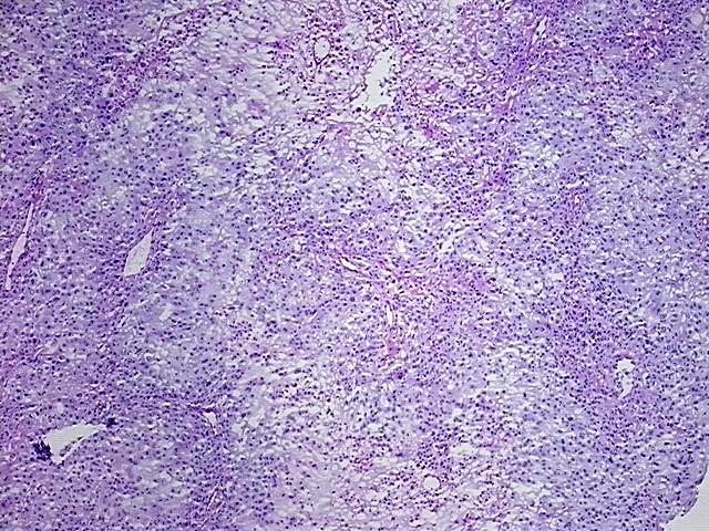 Frozen Tissue Blocks, Breast | CB621461 | OriGene Technologies Inc.