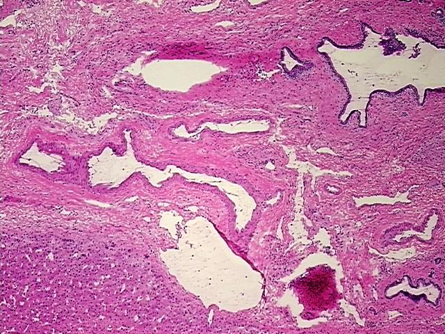 Frozen Tissue Blocks, Liver | CB622878 | OriGene Technologies Inc.