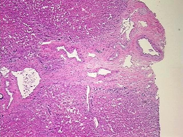 Frozen Tissue Blocks, Liver | CB622884 | OriGene Technologies Inc.