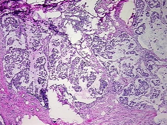Frozen Tissue Blocks, Colon | CB624179 | OriGene Technologies Inc.