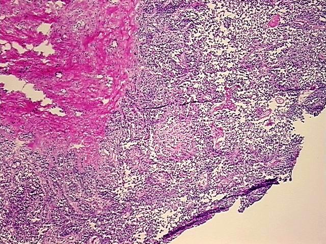 Frozen Tissue Blocks, Multiple urinary system sites | CB631046 ...