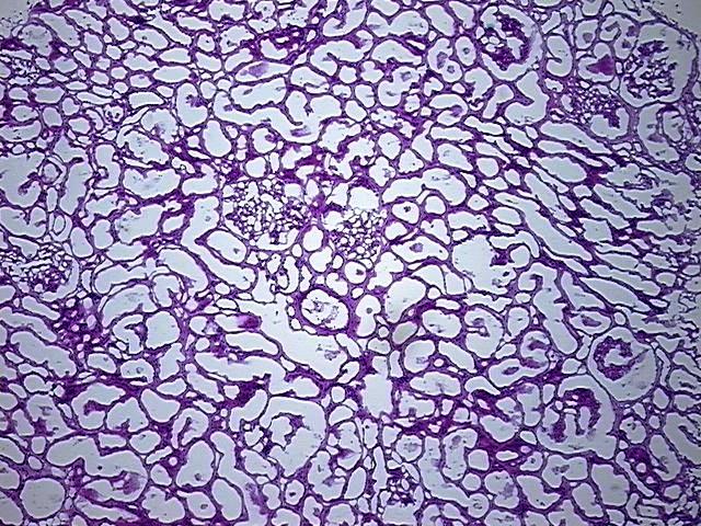 Frozen Tissue Blocks, Kidney | CB639179 | OriGene Technologies Inc.