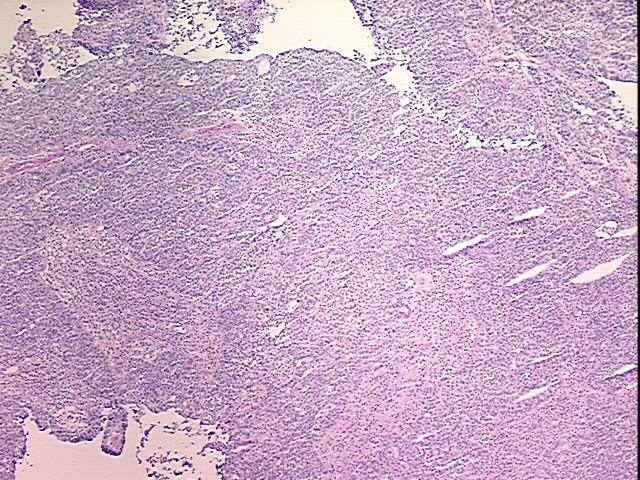 Tissue Protein Lysate, Ovary