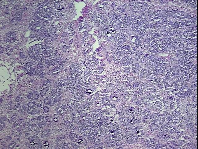 Tissue Protein Lysate, Ovary