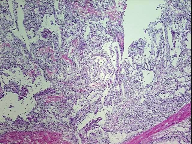Tissue Protein Lysate, Kidney