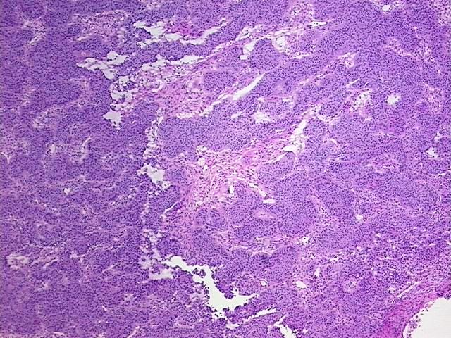 Tissue Protein Lysate, Ovary: right