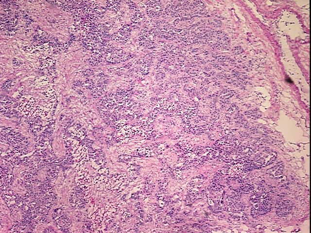 Tissue Protein Lysate, Ovary: right