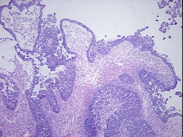 Tissue Protein Lysate, Ovary: right