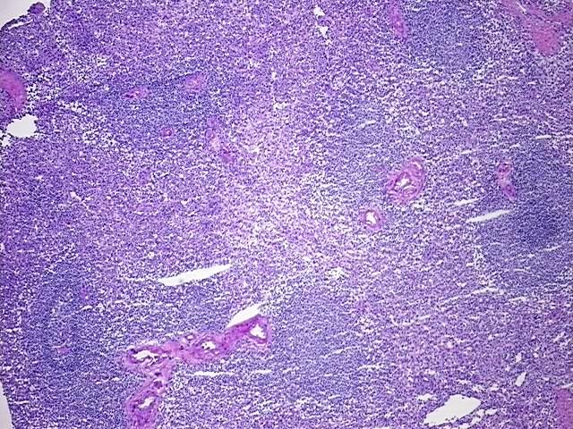Tissue Protein Lysate, Spleen