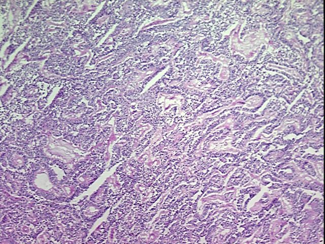 Tissue Protein Lysate, Kidney
