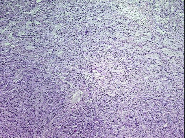 Tissue Protein Lysate, Kidney