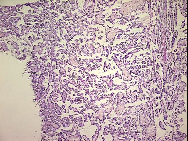 Tissue Protein Lysate, Kidney