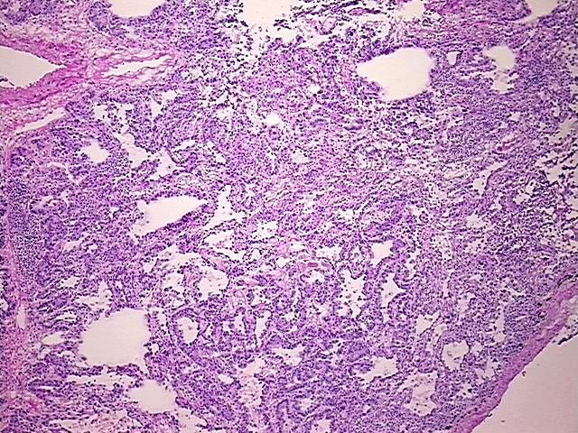 Tissue Protein Lysate, Lung