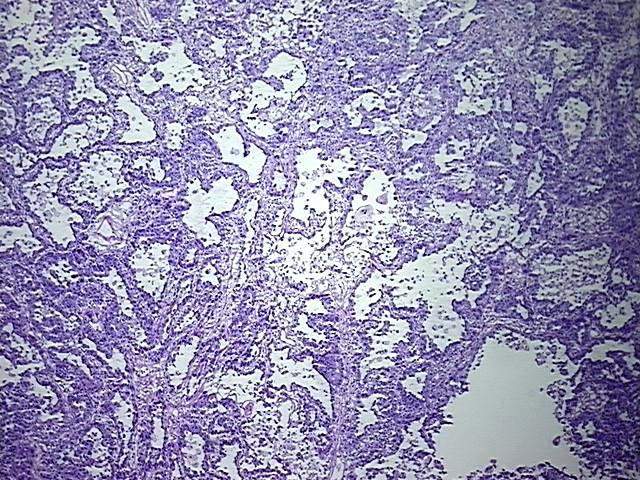 Tissue Protein Lysate, Lung
