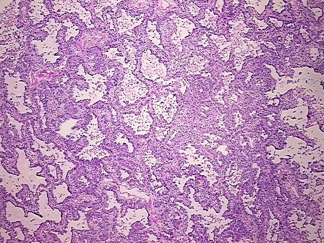 Tissue Protein Lysate, Lung