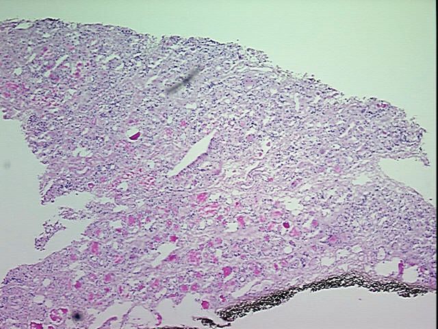 Tissue Protein Lysate, Thyroid gland