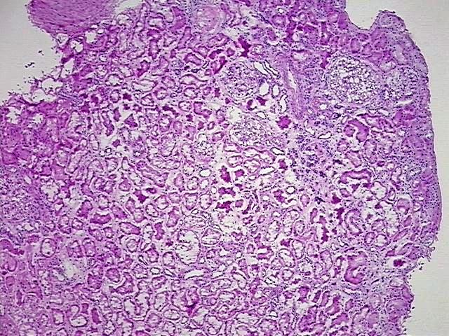 Tissue Protein Lysate, Kidney