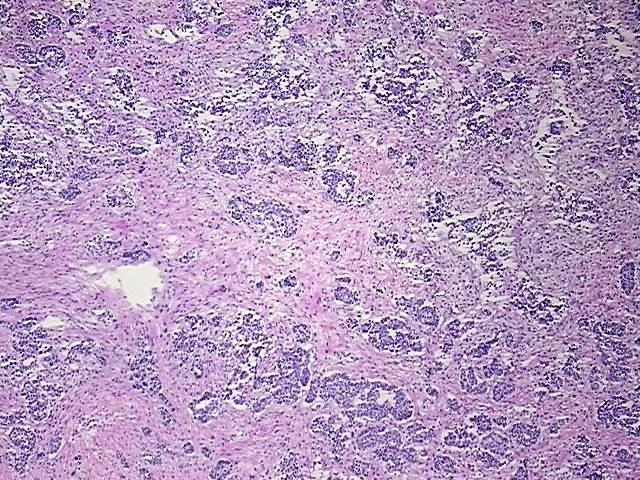 Tissue Protein Lysate, Ovary: bilateral