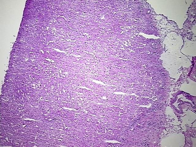 Tissue Protein Lysate, Liver