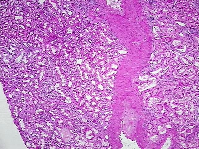 Tissue Protein Lysate, Kidney