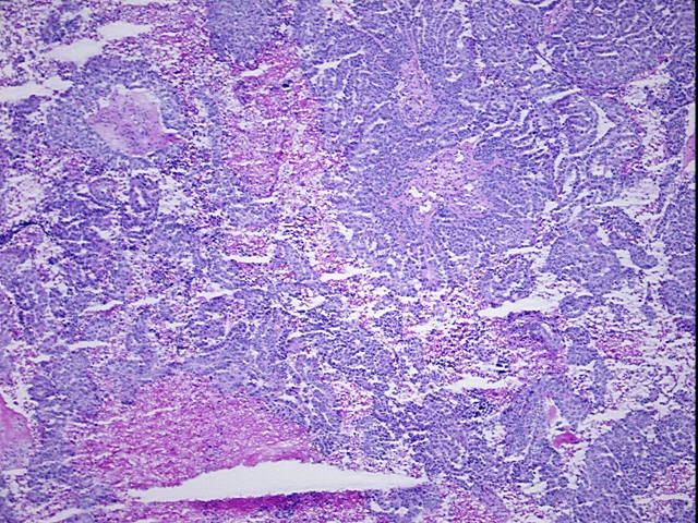 Tissue Protein Lysate, Ovary