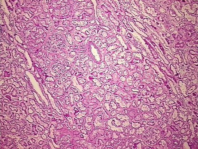 Tissue Protein Lysate, Kidney