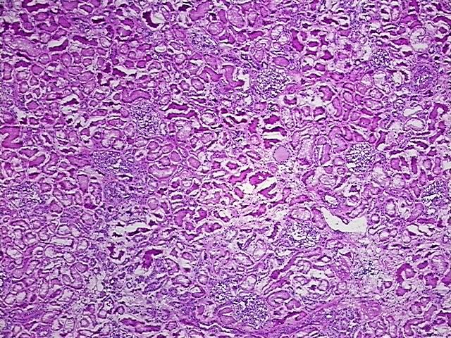 Tissue Protein Lysate, Kidney