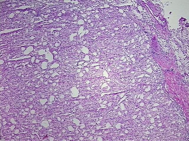 Tissue Protein Lysate, Kidney