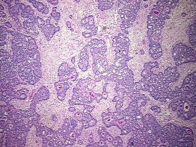 Tissue Protein Lysate, Colon: right