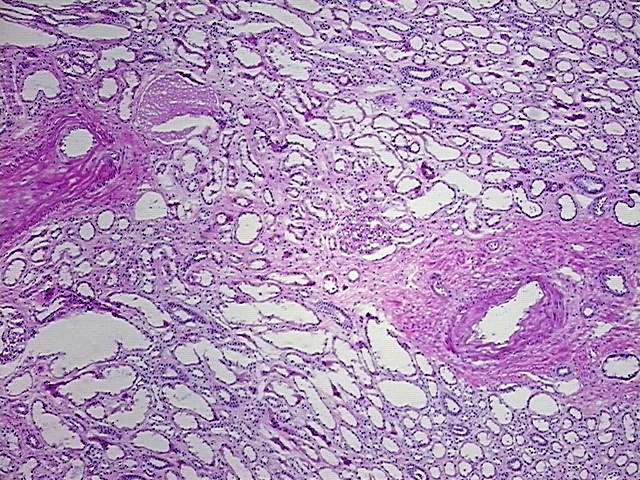Tissue Protein Lysate, Kidney
