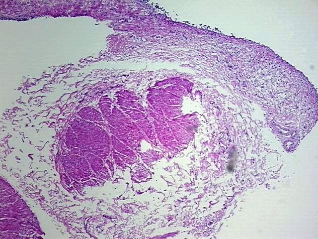 Tissue Protein Lysate, Urinary bladder