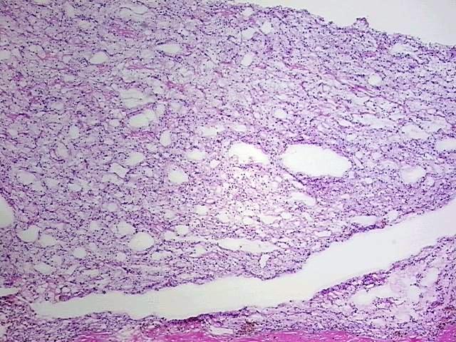 Tissue Protein Lysate, Kidney