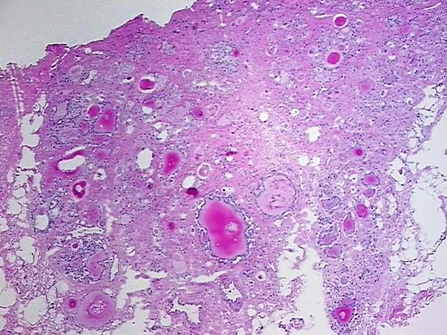 Tissue Protein Lysate, Thyroid gland