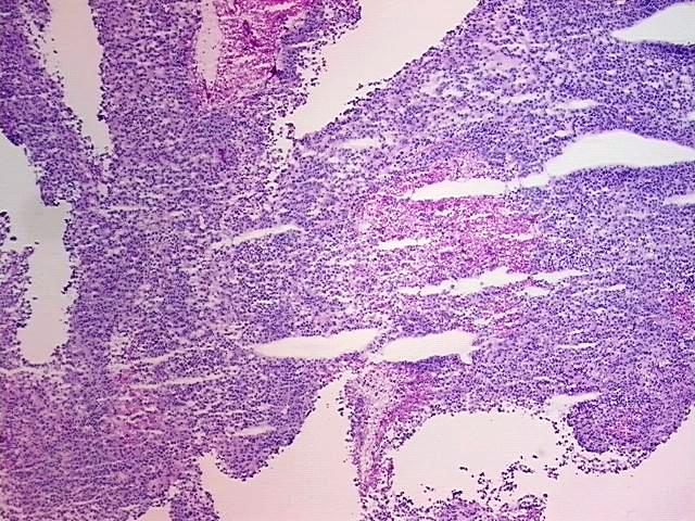Tissue Protein Lysate, Skin