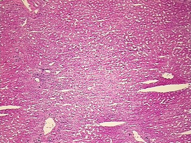 Tissue Protein Lysate, Liver