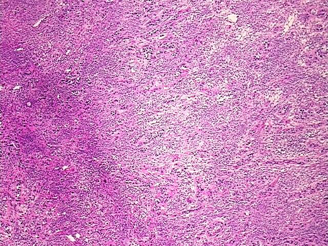 Tissue Protein Lysate, Ovary: right