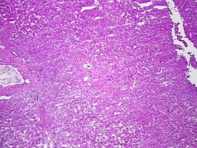 Tissue Protein Lysate, Liver