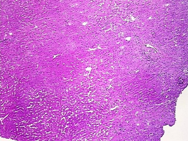Tissue Protein Lysate, Liver