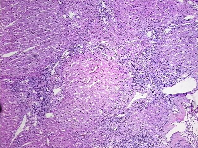 Tissue Protein Lysate, Liver